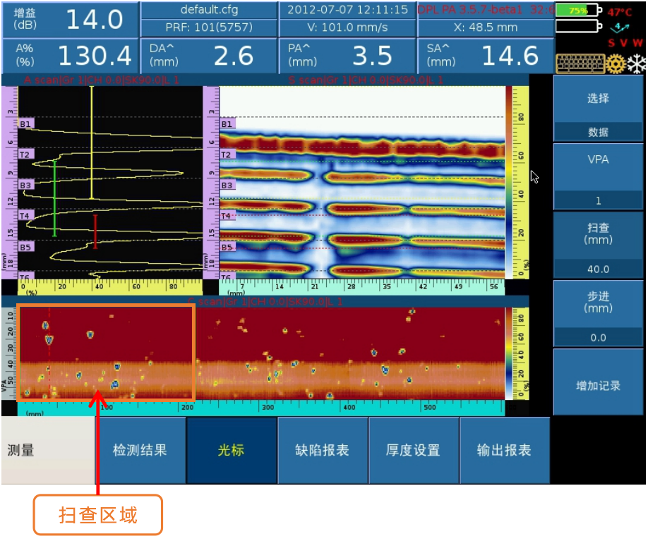 扫查1图.png